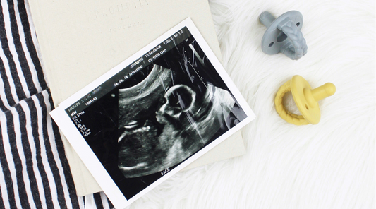 Baby sonogram image with two pacifiers next to it.